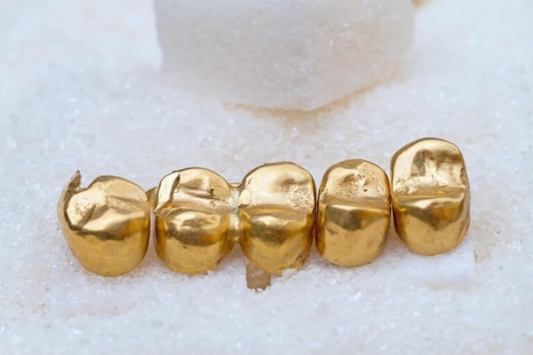 Gold nugget in teeth